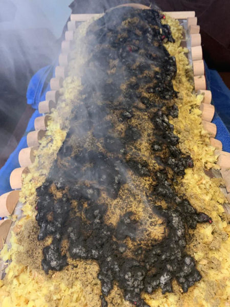 圖片 陰陽灸