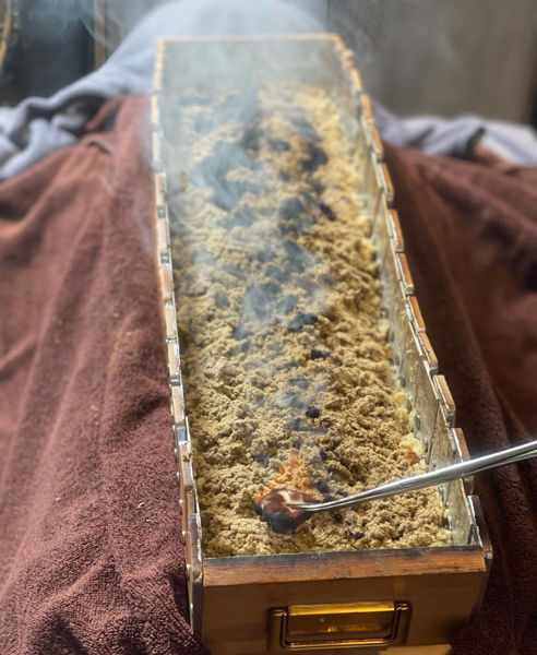 圖片 龍骨督脈灸